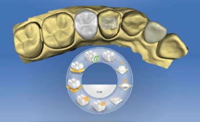 Arbeiten im zahntechnischen Labor, Cerec - Ceramic Reconstruction [HP] 