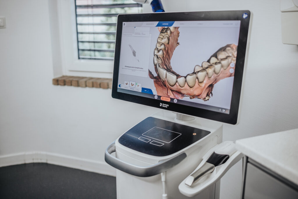 Moderne Zahnmedizin in Kassel: Intraoralscanner zur abdruckfreien, digitalen Gebissaufnahme in der Praxis Dr. Kollmar.