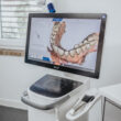 Moderne Zahnmedizin in Kassel: Intraoralscanner zur abdruckfreien, digitalen Gebissaufnahme in der Praxis Dr. Kollmar.