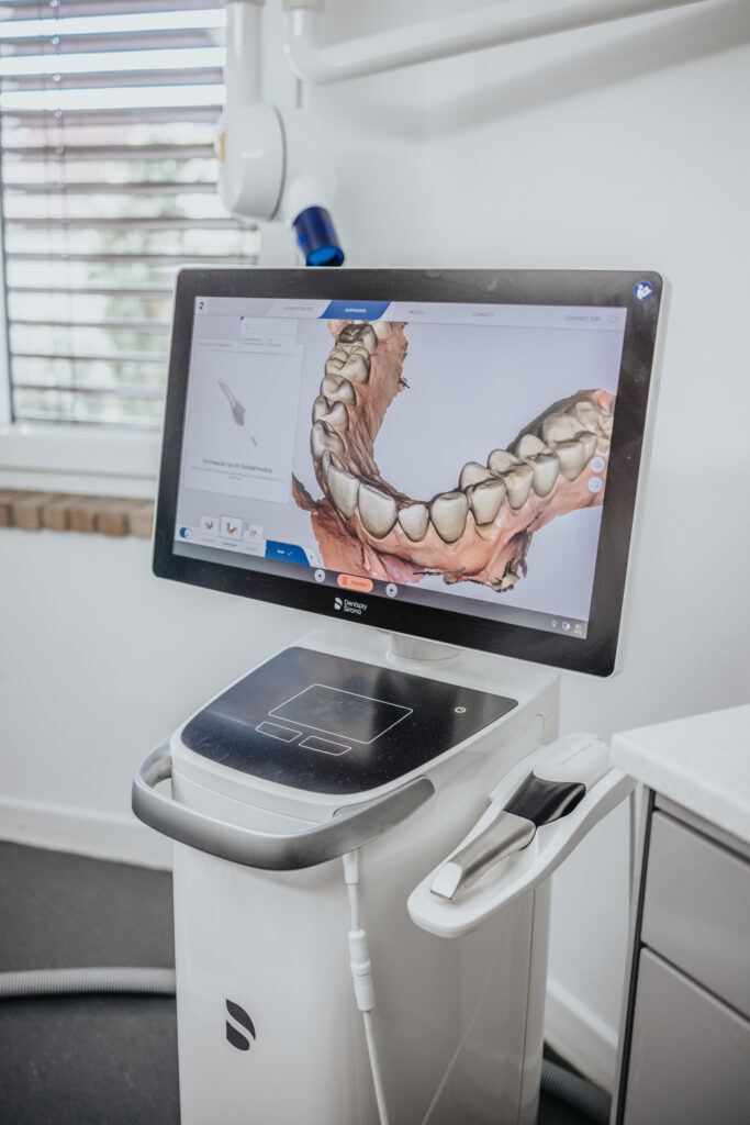 Moderne Zahnmedizin in Kassel: Intraoralscanner zur abdruckfreien, digitalen Gebissaufnahme in der Praxis Dr. Kollmar.